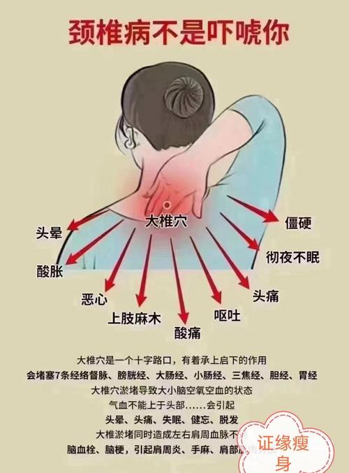 颈椎增生 骨刺艾灸穴位