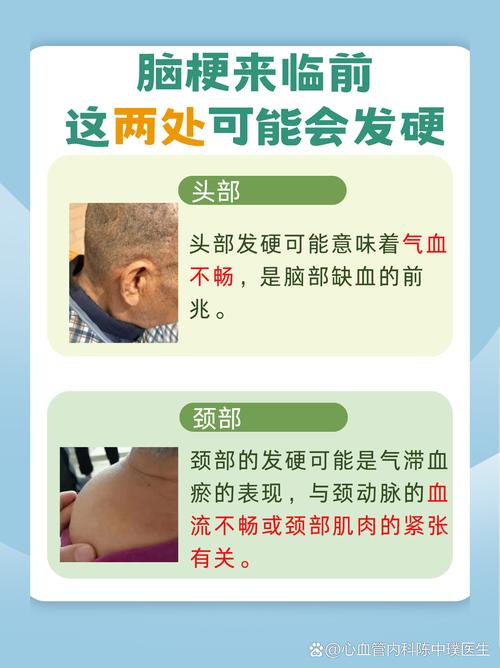 脑梗发病前有什么症状有哪些