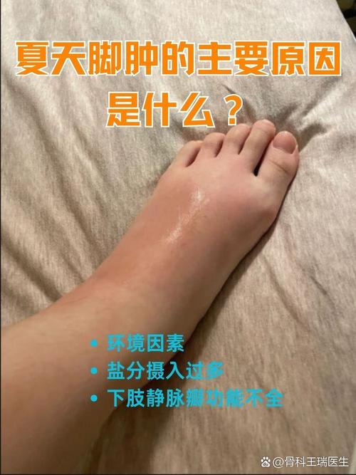 脑梗病人脚脖子肿是怎么回事