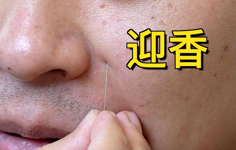 鼻子不通 艾灸什么穴位