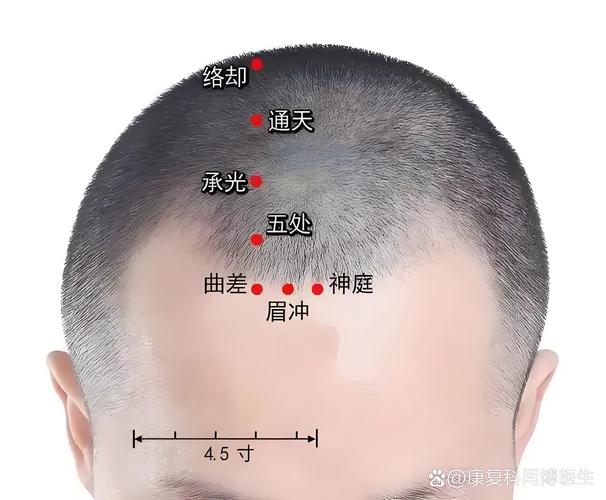 脑出血 康复 按摩穴位