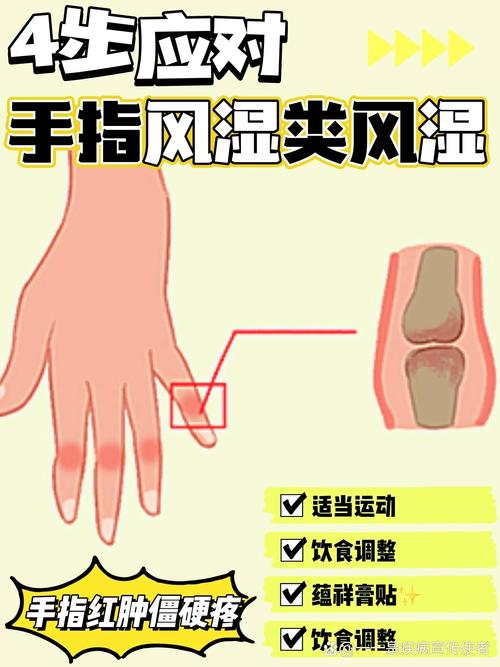 手指关节变形是风湿还是类风湿