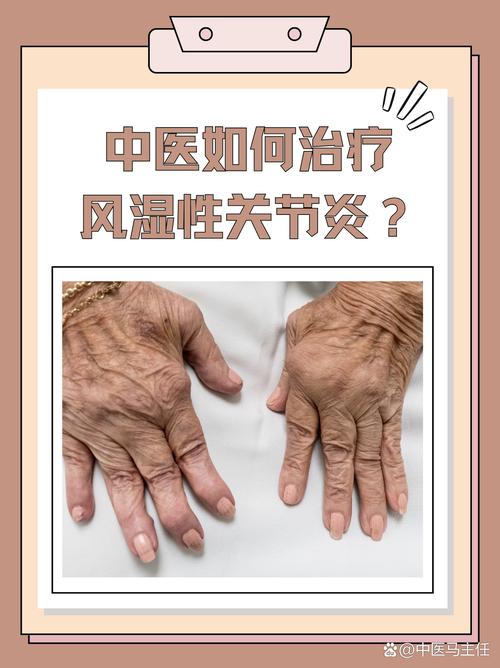 风湿病早期的症状风湿病好治吗