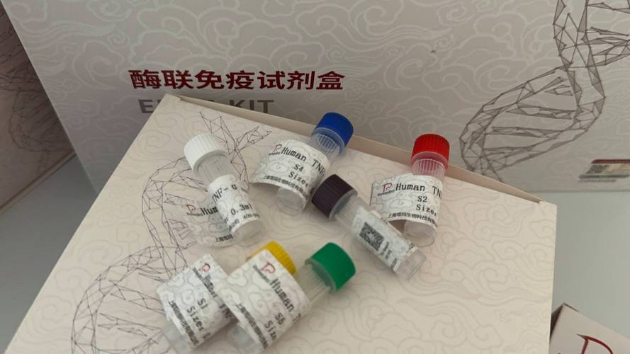 elisaigm类风湿因子