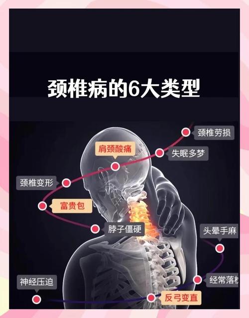 颈椎可以导致脑梗和心梗嘛