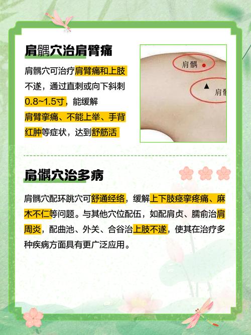 针灸治疗肩周炎特效穴位