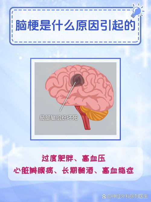 脑梗是因为什么原因引起的