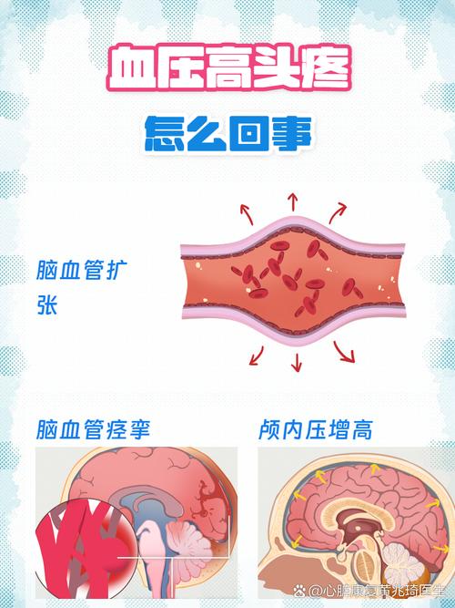 脑梗血压突然升高血塞通