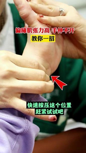 脑梗手脚不便 按摩头部