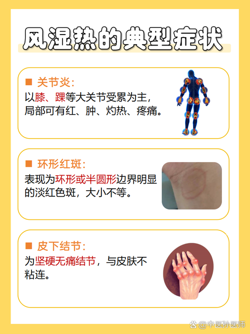 免疫风湿病是什么原因导致的