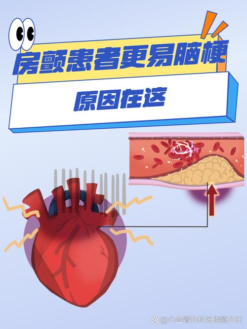 高血压 房颤 轻度脑梗