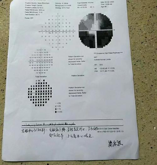 脑梗 恢复 眼神经萎缩