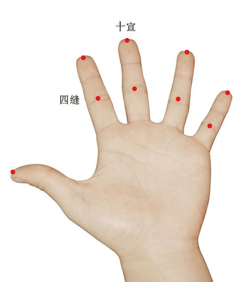 中医针灸穴位十宣穴位置