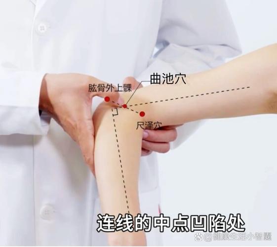 曲池穴位如何做穴位注射
