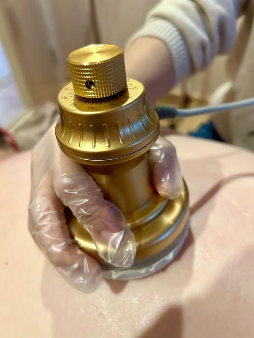 穴位埋线治疗过敏性哮喘