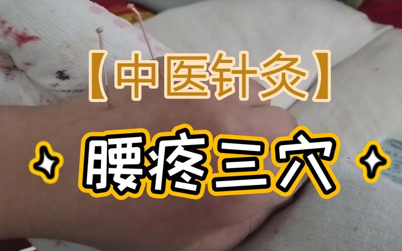 腰椎间盘突出症针灸穴位