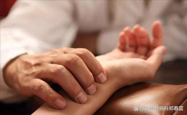 治类风湿类风湿病的地方