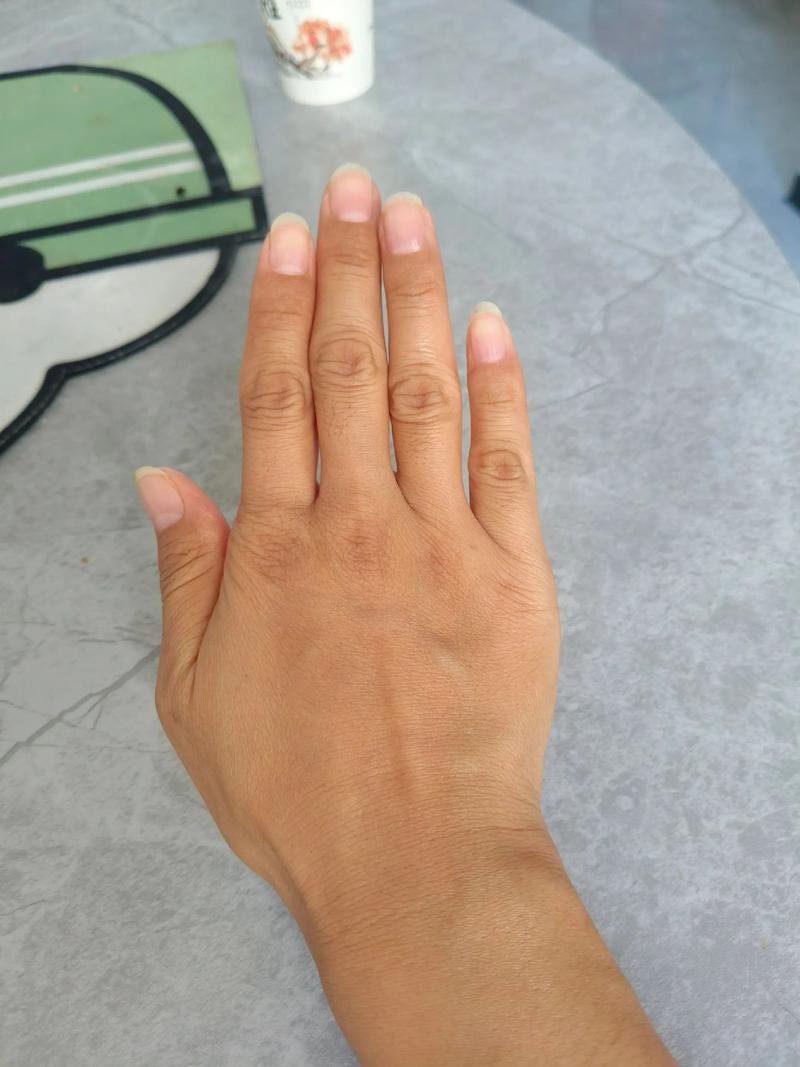 风湿病早期的症状风湿病