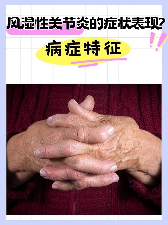 风湿病早期的症状风湿病