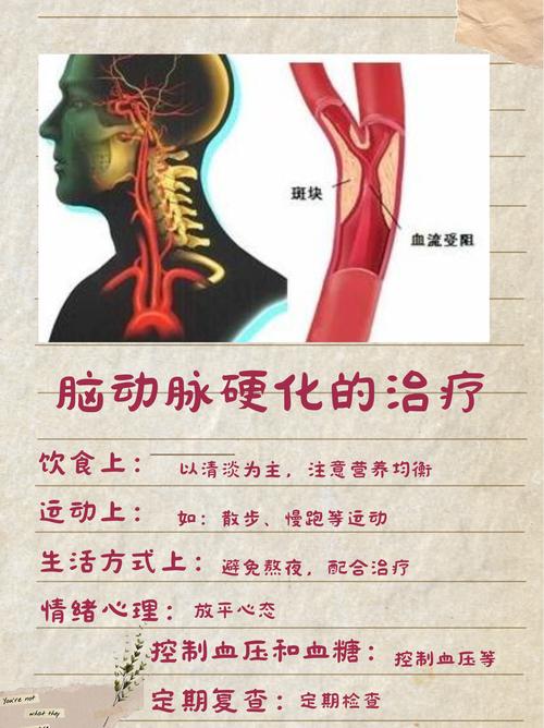 脑腔梗代表脑动脉硬化吗
