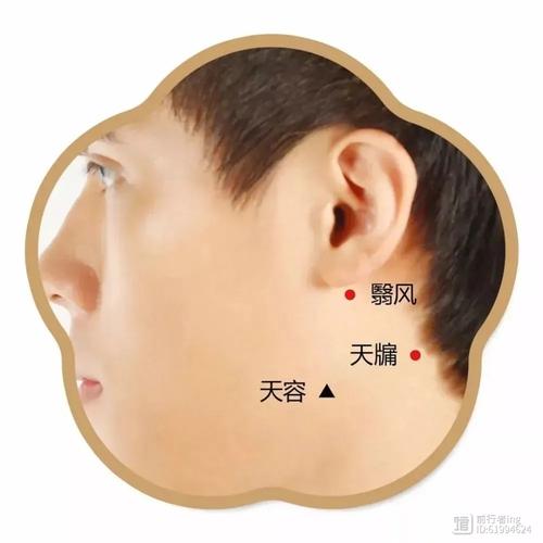 面瘫需要艾灸哪些穴位