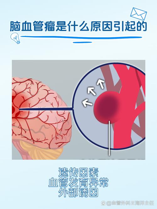脑管瘤破裂和脑梗的区别