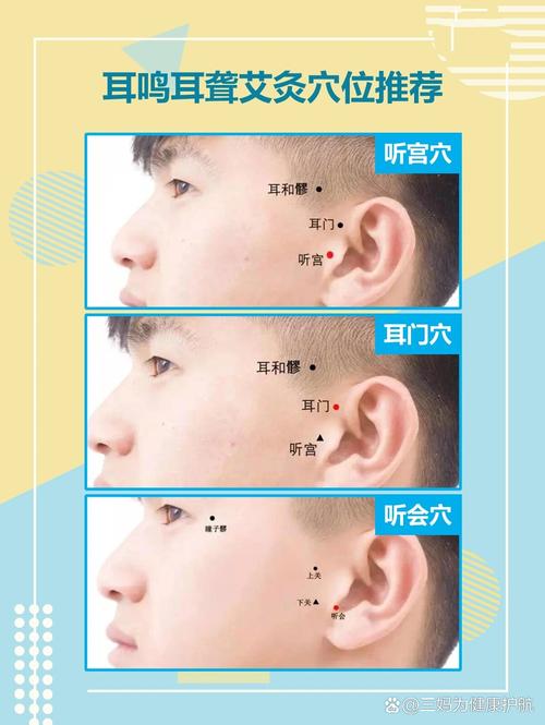 按摩哪些穴位治疗耳鸣