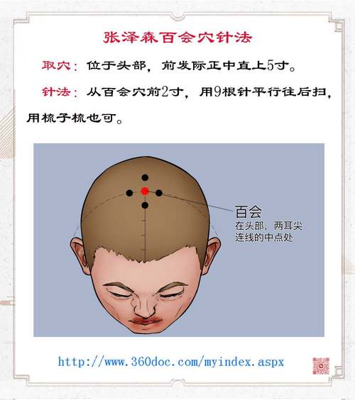 脑瘫针灸哪个穴位最佳