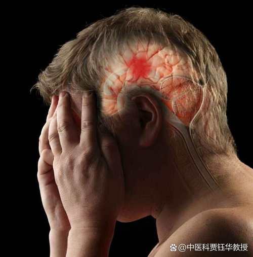 小脑脑梗恢复期脑有点疼