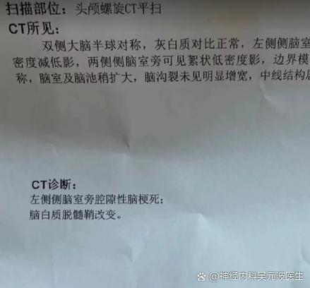 双侧脑旁多发缺血脑梗灶