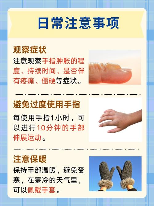 手有风湿 类风湿怎么办