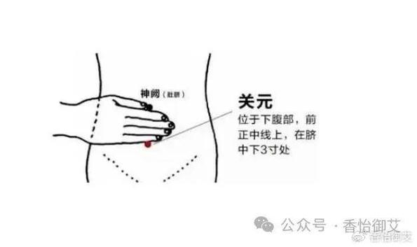 艾灸穴位治疗尿频尿急