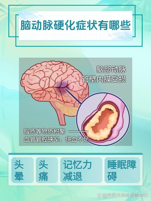 脑动脉硬化与脑梗的区别