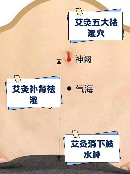 小儿湿疹艾灸什么穴位