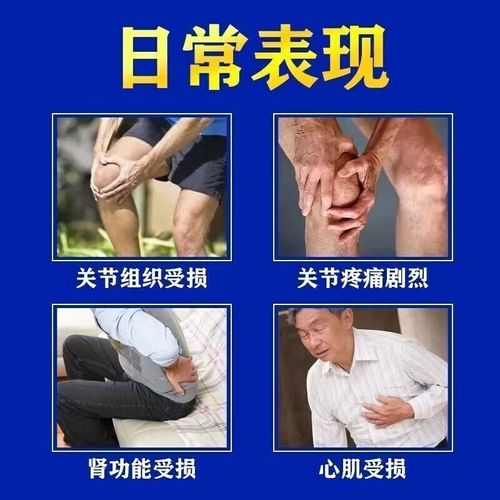 风湿及类风湿的联合用药