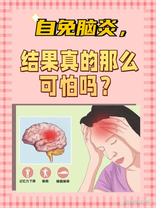 风湿性脑脑炎属于风湿吗