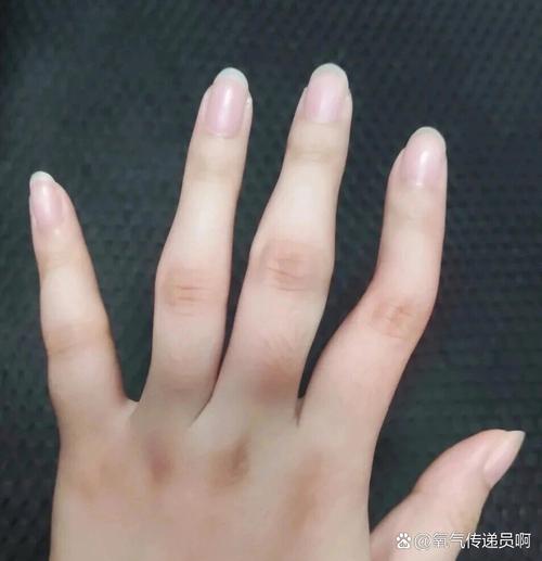 风湿因子多高是风湿病啊