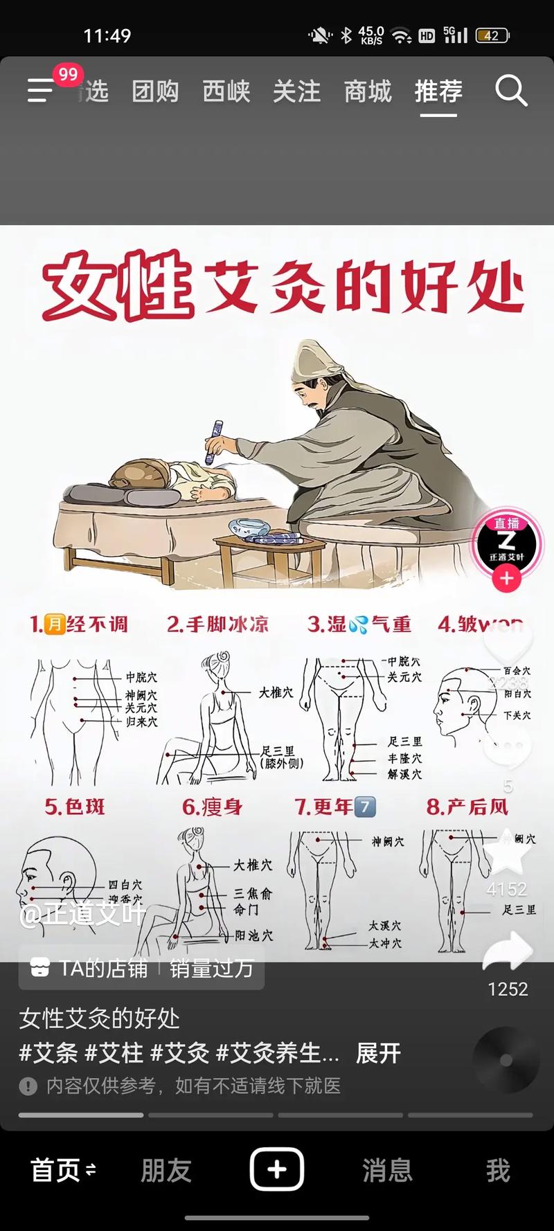 艾灸对风湿类风湿有用吗