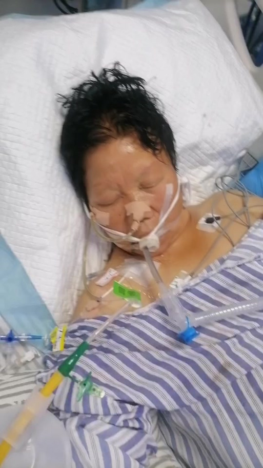 脑梗出院后还有梗的地方