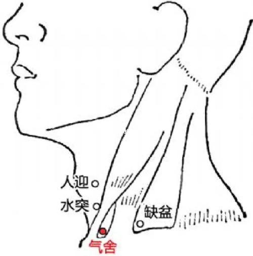 嗓子沙哑刮痧哪些穴位