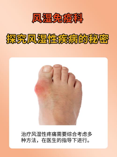 风湿免疫科属于风湿病么