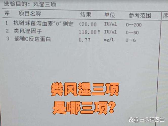 风湿三项类风湿因子52