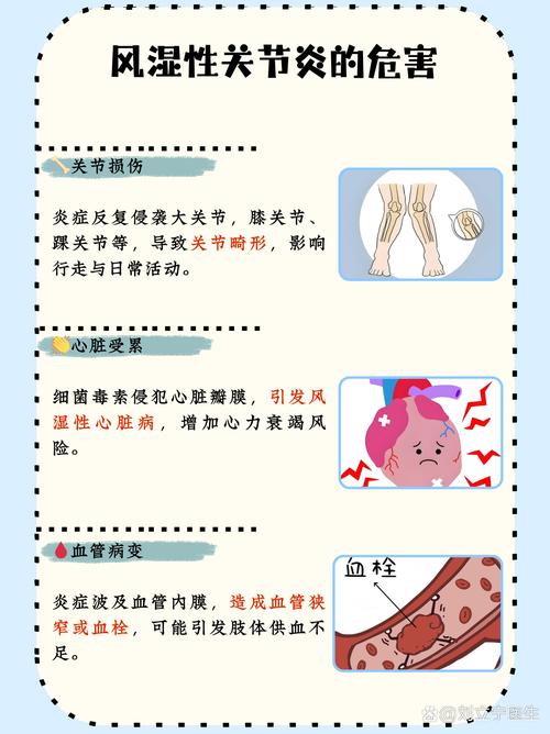 风湿和内风湿关节炎区别