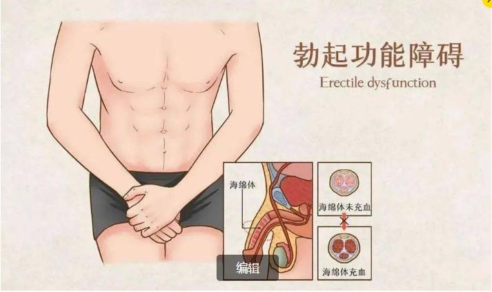 穴位按摩治疗勃起障碍