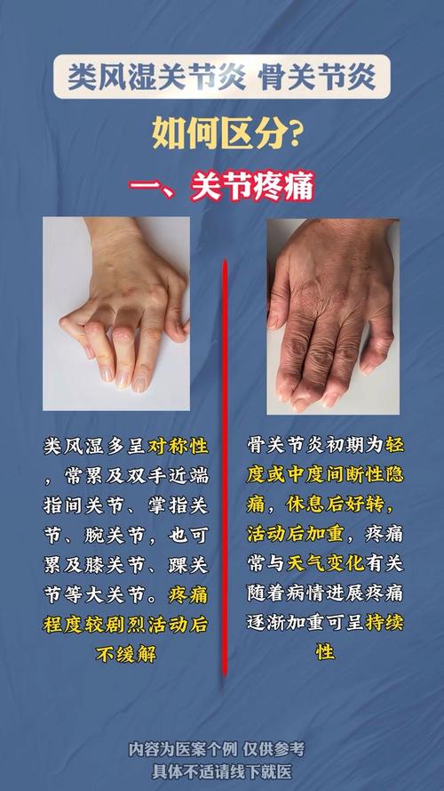 风湿类风湿可引起发烧吗