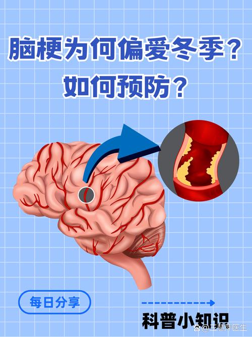 冬季为何更容易心梗脑梗