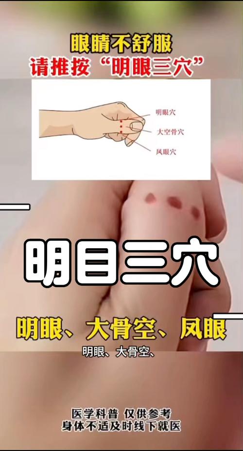 儿童弱视穴位按摩眼镜