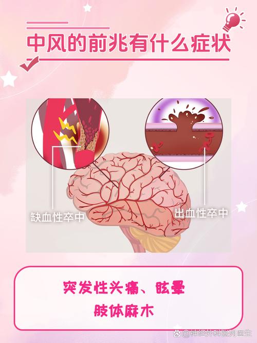 所谓中风是心梗还是脑梗