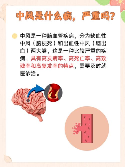 所谓中风是心梗还是脑梗