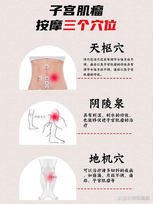 子宫肌瘤穴位按摩视频